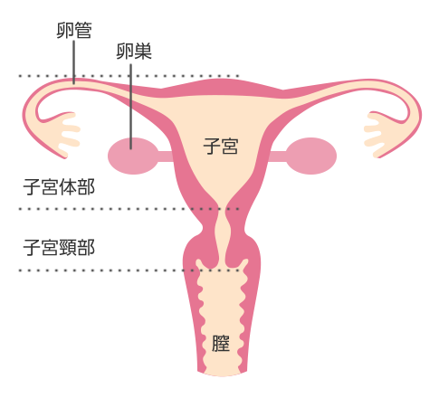 子宮肉腫と子宮筋腫の違い鑑別法